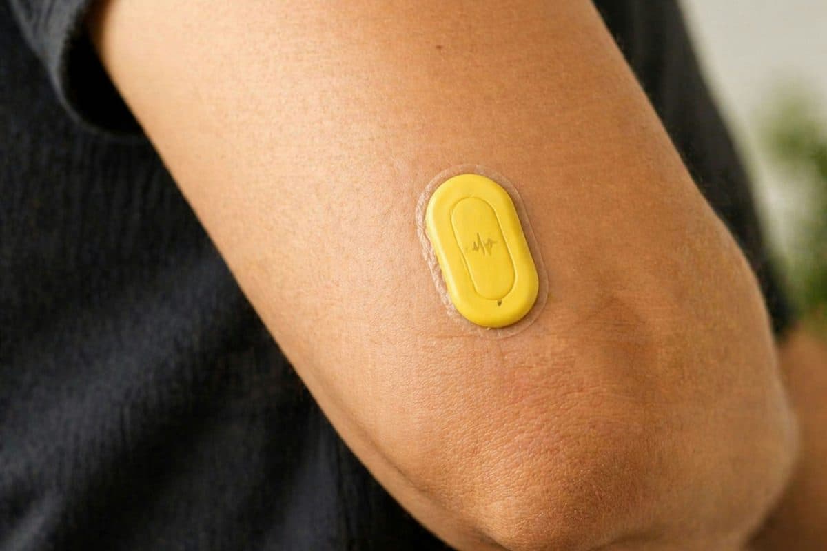 Glucose Monitoring
